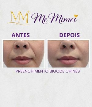 Preenchimento Bigode Chinés